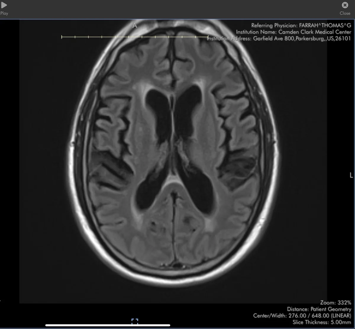 Inside My Mind: A Glimpse of My Brain!