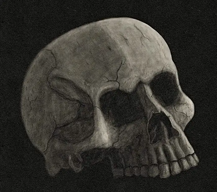 A grayscale, highly detailed drawing of a human skull with visible cracks and teeth, set against a dark background. The…