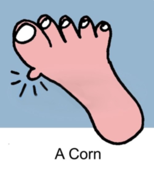 A simple cartoon drawing of a pink human foot with five toes, angled upward against a light blue background. The big toe is…