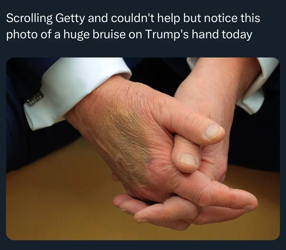 A close-up photo shows an older man's hands clasped together, wearing a dark suit and white dress shirt with cufflinks. A…