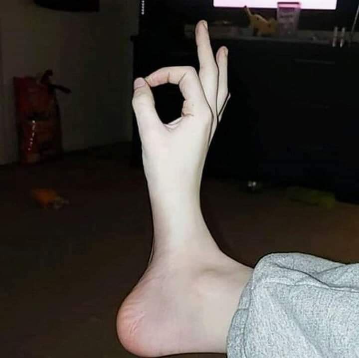 A close-up photo shows a person's bare foot with the toes curled inward and the heel resting on the floor, while the hand is…