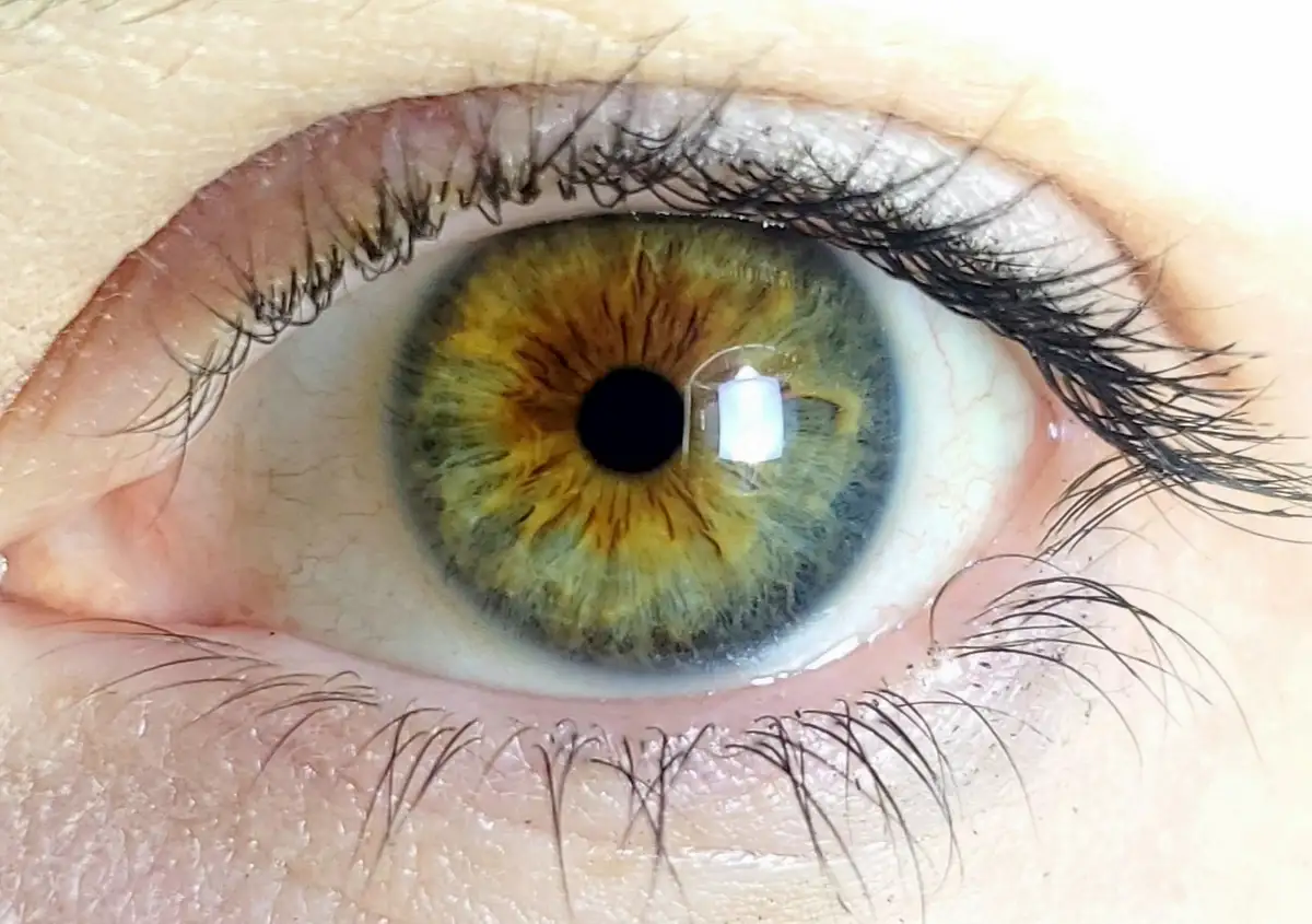 A close-up photo of a human eye with a greenish-yellow iris and black pupil, showing detailed eyelashes and skin texture…