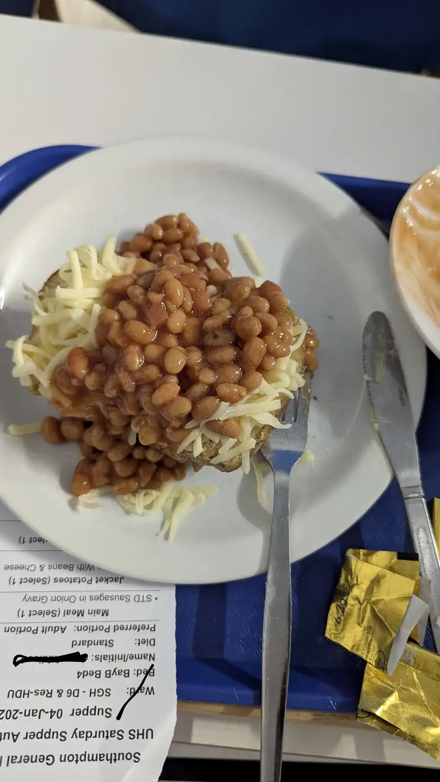 A close-up photo shows a hospital meal on a white plate, featuring a jacket potato topped with baked beans and shredded…
